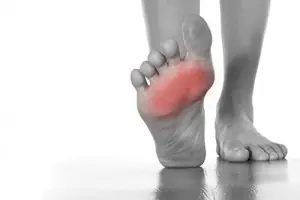 A bare foot raised from the floor, with the ball of the foot shaded red to show pain