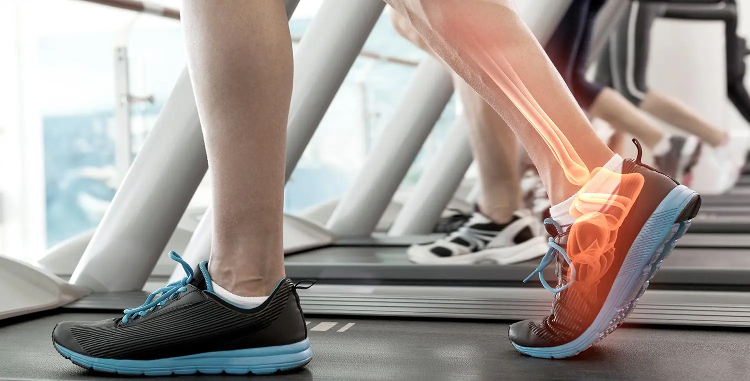People walk on treadmills, with the bones of one foot and ankle shown glowing orange