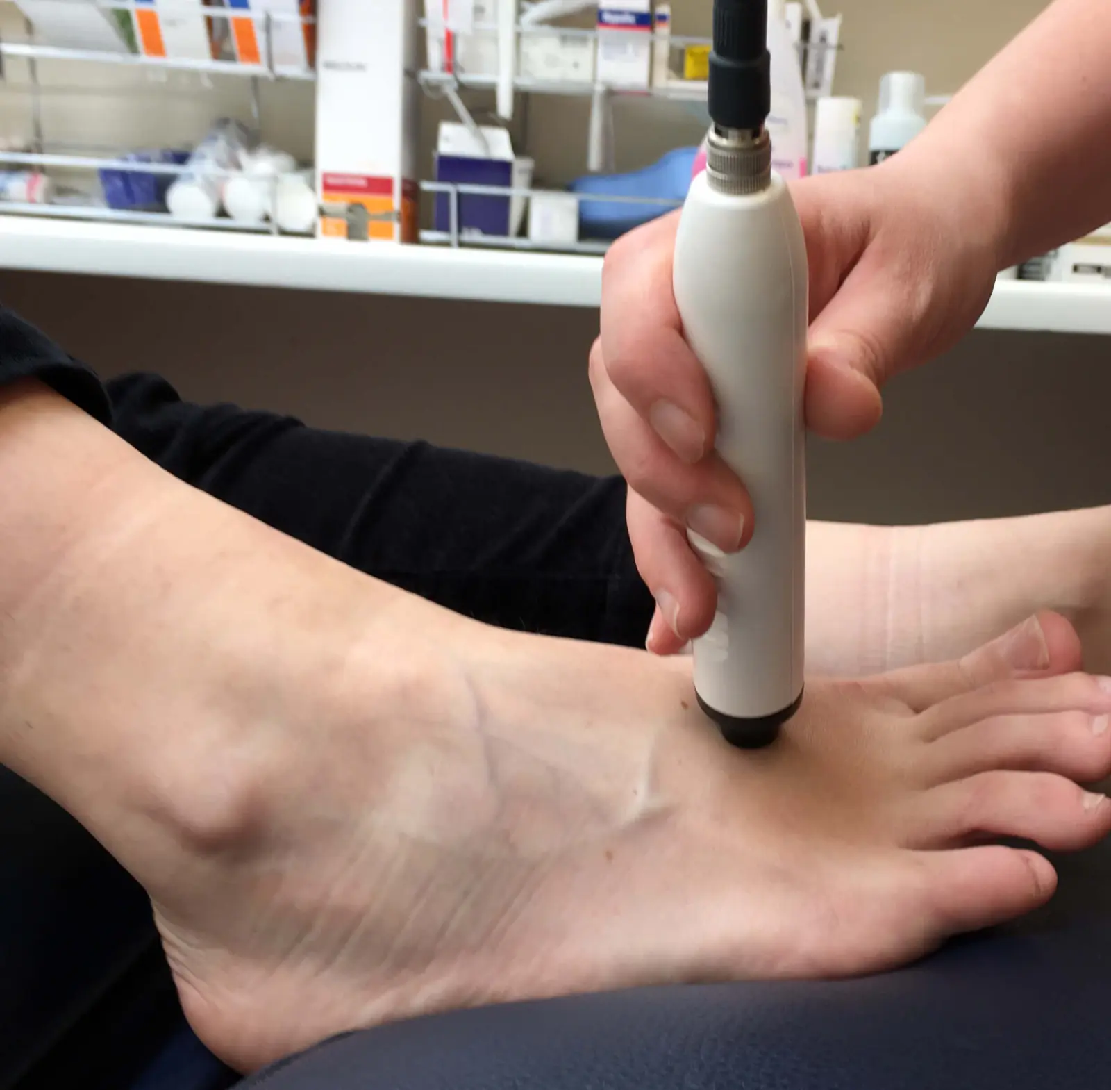 A handheld Doppler probe placed on top of a patient's foot to check blood flow