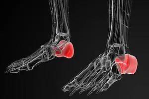 3D image of the bones of both feet, with the heel bone highlighted in red
