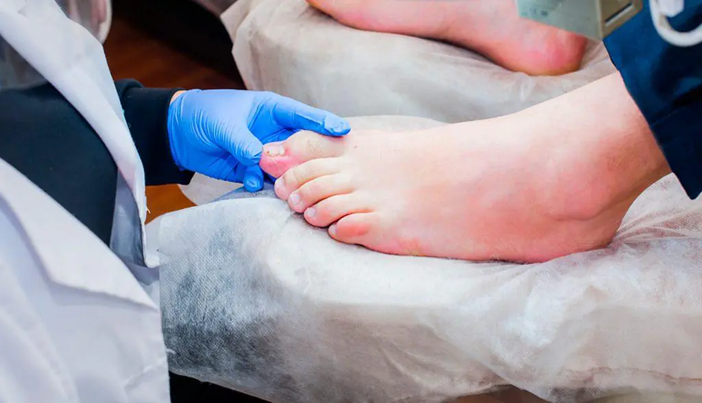 Diabeties Assessment