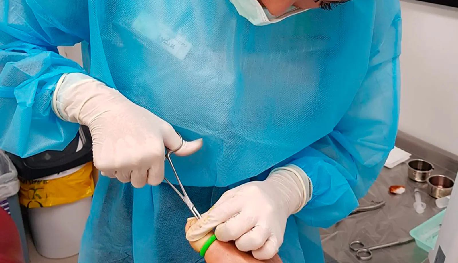 A podiatrist in a surgical gown, mask and gloves works on a patient's toe with forceps